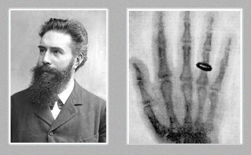 Wilhelm Röntgen y la primera radiografía